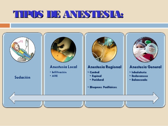 anestesia general y regional pdf
